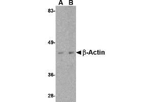 Western blot analysis of actin in HeLa cell lysate with beta-actin antibody at (A) 1 and (B) 2 µg/mL. (beta Actin Antikörper  (C-Term))