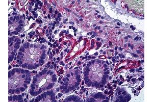 Immunohistochemistry (IHC) image for anti-Protein Phosphatase 3, Catalytic Subunit, alpha Isoform (PPP3CA) (AA 21-51) antibody (ABIN1804070)