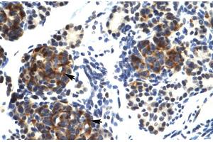 Human Pancreas (TRIM41 Antikörper  (C-Term))