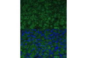 Immunofluorescence analysis of mouse pancreas using CTRB1 Polyclonal Antibody (ABIN7266398) at dilution of 1:100 (40x lens). (CTRB1 Antikörper  (AA 79-263))