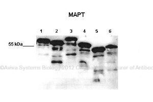 Researcher: Max Holzer, Paul Flechsig Institut of Brain Research, University of Leipzig  Application: Western blotting  Species + Tissue/Cell type:   Lane 1: 10ug E. (MAPT Antikörper  (Middle Region))