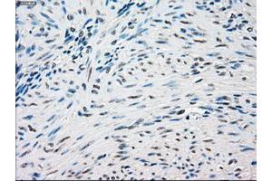 Image no. 2 for anti-Sjogren Syndrome Antigen B (SSB) antibody (ABIN1501143) (SSB Antikörper)