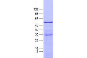 Validation with Western Blot (PFKFB2 Protein (His tag))