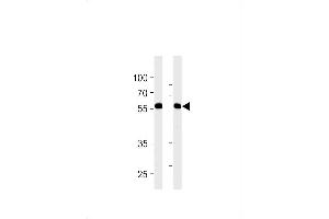 RFTN1 Antibody (Center) (ABIN1881746 and ABIN2843233) western blot analysis in MDA-MB-231,NCI- cell line lysates (35 μg/lane). (RFTN1 Antikörper  (AA 169-198))