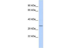 WB Suggested Anti-NMRAL1 Antibody Titration: 0. (NMRAL1 Antikörper  (Middle Region))