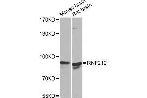 Western blot analysis of extracts of various cell lines, using RNF219 Antibody. (RNF219 Antikörper)