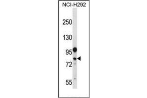 Western blot analysis of DDX3Y Antibody (N-term) in NCI-H292 cell line lysates (35ug/lane). (DDX3Y Antikörper  (N-Term))