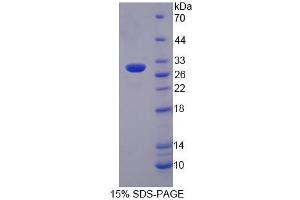 SDS-PAGE analysis of Mouse PTPRN2 Protein. (PTPRN2 Protein)