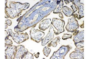 IHC analysis of MMP16 using anti-MMP16 antibody .