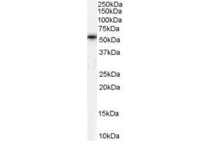 Western Blotting (WB) image for anti-Chromosome 20 Open Reading Frame 96 (C20ORF96) (N-Term) antibody (ABIN2791311)