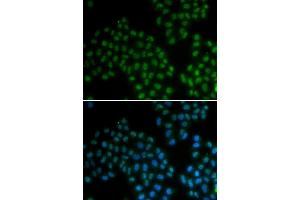 Immunofluorescence analysis of MCF7 cell using SOX2 antibody. (SOX2 Antikörper  (AA 1-140))