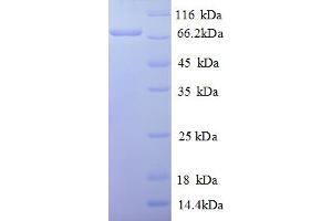 SDS-PAGE (SDS) image for REL proto-oncogene (c-Rel) (AA 3-616), (partial) protein (His tag) (ABIN5713102)