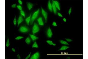 Immunofluorescence of purified MaxPab antibody to RPL29 on HeLa cell. (RPL29 Antikörper  (AA 1-157))