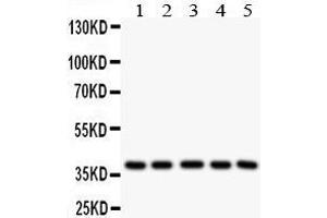Anti- LOX1 antibody, Western blotting All lanes: Anti LOX1  at 0. (OLR1 Antikörper  (Middle Region))