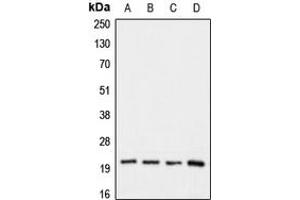 Western blot analysis of Claudin 1 expression in HeLa (A), HepG2 (B), mouse kideney (C), rat kidney (D) whole cell lysates. (Claudin 1 Antikörper  (C-Term))