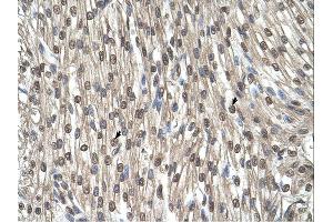 Immunohistochemistry (IHC) image for anti-serine Hydroxymethyltransferase 2 (Mitochondrial) (SHMT2) (C-Term) antibody (ABIN2782503) (SHMT2 Antikörper  (C-Term))