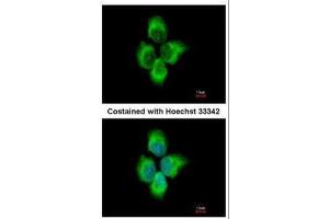 ICC/IF Image Immunofluorescence analysis of methanol-fixed A431, using MMP8, antibody at 1:500 dilution.