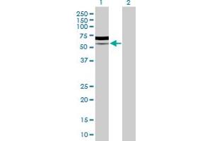 Western Blot analysis of PIK3R5 expression in transfected 293T cell line by PIK3R5 MaxPab polyclonal antibody. (PIK3R5 Antikörper  (AA 1-494))