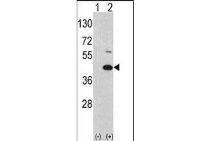 Western blot analysis of MOS (arrow) using rabbit polyclonal hMOS-R8 (ABIN392644 and ABIN2842147). (MOS Antikörper  (N-Term))