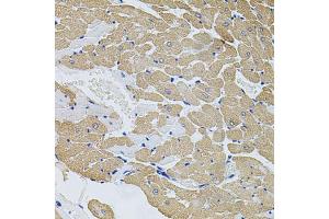 Immunohistochemistry of paraffin-embedded rat heart using CAST antibody (ABIN2650901) at dilution of 1:100 (40x lens).