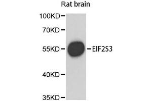 Western blot analysis of extracts of rat brain, using EIF2S3 antibody. (EIF2S3 Antikörper)
