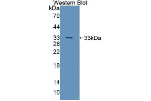 Western blot analysis of the recombinant protein. (TSSK1 Antikörper  (AA 52-309))