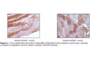 Image no. 1 for anti-Myoglobin (MB) antibody (ABIN207623) (Myoglobin Antikörper)
