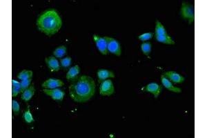 Immunofluorescent analysis of PC-3 cells using ABIN7157515 at dilution of 1:100 and Alexa Fluor 488-congugated AffiniPure Goat Anti-Rabbit IgG(H+L) (KIR2DS3 Antikörper  (AA 102-241))