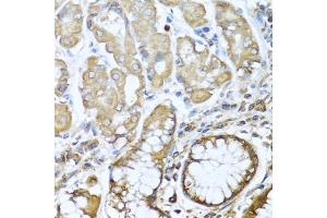 Immunohistochemistry of paraffin-embedded human stomach using NRG4 antibody (ABIN3016309, ABIN3016310, ABIN3016311 and ABIN6219713) at dilution of 1:100 (40x lens). (Neuregulin 4 Antikörper  (AA 1-115))