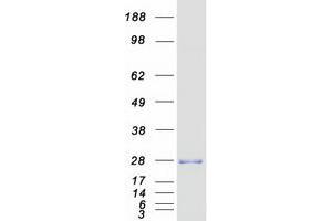 Western Blotting (WB) image for Cytidine Monophosphate (UMP-CMP) Kinase 1, Cytosolic (CMPK1) (Transcript Variant 1) protein (Myc-DYKDDDDK Tag) (ABIN2712896)