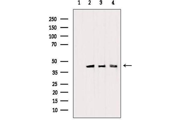 PDHA1 Antikörper  (C-Term)