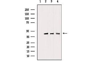 Western blot analysis of extracts from various samples, using PDHA1 Antibody. (PDHA1 Antikörper  (C-Term))