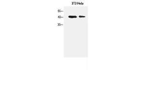 Western Blot analysis of 3T3, Hela cells using α-SMA Polyclonal Antibody at dilution of 1:1500. (alpha-SMA Antikörper)