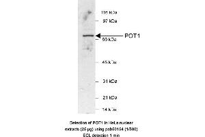 Image no. 1 for anti-Protection of Telomeres 1 (POT1) (AA 200-300) antibody (ABIN363463)