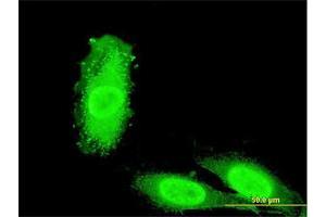 Immunofluorescence of monoclonal antibody to IRAK3 on HeLa cell. (IRAK3 Antikörper  (AA 497-596))