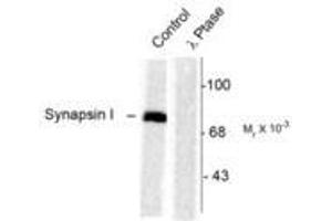 Image no. 1 for anti-Synapsin I (SYN1) (pSer603) antibody (ABIN227585) (SYN1 Antikörper  (pSer603))