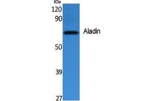 Western Blotting (WB) image for anti-Achalasia, Adrenocortical Insufficiency, Alacrimia (AAAS) (C-Term) antibody (ABIN3187610)