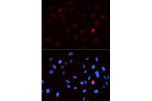 Immunofluorescence analysis of MCF-7 cells using Phospho-CDK1-T14 antibody (ABIN5969876). (CDK1 Antikörper  (pThr14))