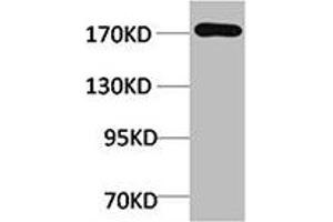 Western blot analysis of Rat Liver Tissue using EPG5 Polyclonal Antibody. (EPG5 Antikörper)