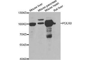 Western blot analysis of extracts of various cell lines, using PDE6B antibody. (PDE6B Antikörper)