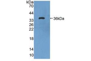 Figure. (FLT1 Antikörper  (AA 18-308))