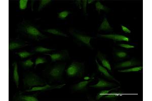 Immunofluorescence (IF) image for anti-Ribosomal Protein S6 Kinase, 70kDa, Polypeptide 2 (RPS6KB2) (AA 1-482) antibody (ABIN948425)