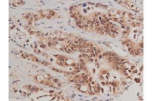 Immunohistochemistry (IHC) image for anti-Caspase 3 (CASP3) (pSer150) antibody (ABIN6254994)