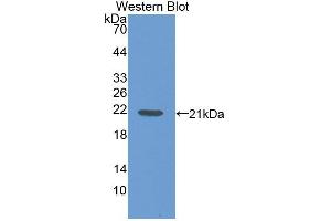 Western blot analysis of the recombinant protein. (FIL1d Antikörper  (AA 1-156))