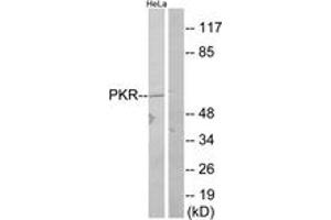 Western blot analysis of extracts from HeLa, using PKR (Ab-446) Antibody. (EIF2AK2 Antikörper  (AA 413-462))