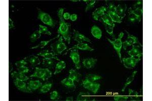 Immunofluorescence of monoclonal antibody to ACBD3 on HeLa cell.