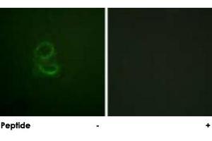 Immunofluorescence analysis of A-549 cells, using IL4R polyclonal antibody . (IL4 Receptor Antikörper)