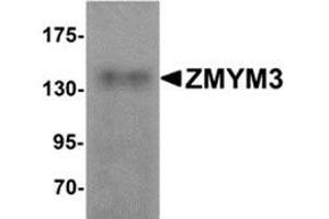 Western blot analysis of ZMYM3 in human brain tissue lysate with ZMYM3 antibody at 1 μg/ml.