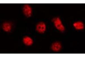 ABIN6278559 staining LOVO by IF/ICC. (CLK4 Antikörper  (Internal Region))