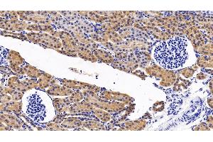 Detection of MAPK14 in Porcine Kidney Tissue using Polyclonal Antibody to Mitogen Activated Protein Kinase 14 (MAPK14) (MAPK14 Antikörper  (AA 19-279))